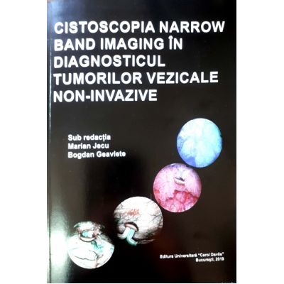 Cistoscopia narrow band imaging in diagnosticul tumorilor vezicale non-invazive - Marian Jecu Bogdan Geavlete