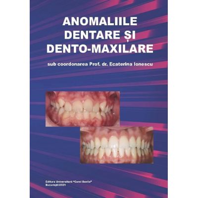 Anomaliile dentare si dento-maxilare - Ecaterina Ionescu