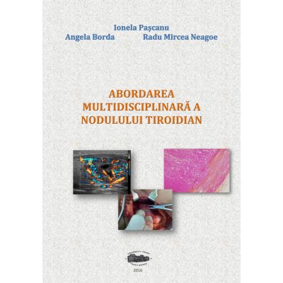 Abordarea multidisciplinara a nodulului tiroidian - Ionela Pascanu