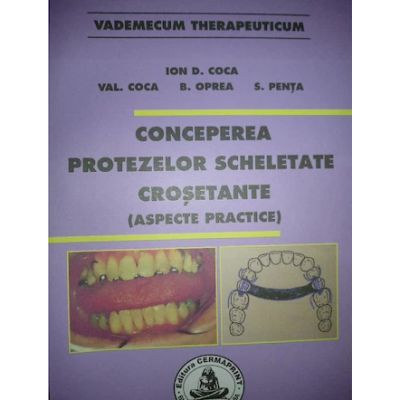 Conceperea protezelor scheletate crosetante - Ion Coca