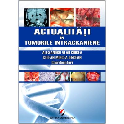 Actualitati in tumorile intracraniene - Prof. Dr. MSc. Alexandru Vlad Ciurea, Dr. Stefan Mircea Iencean