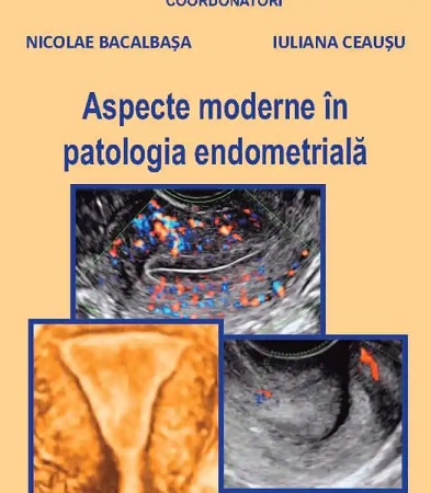 Aspecte moderne in patologia endometriala - Nicolae Bacalbasa, Iuliana Ceausu