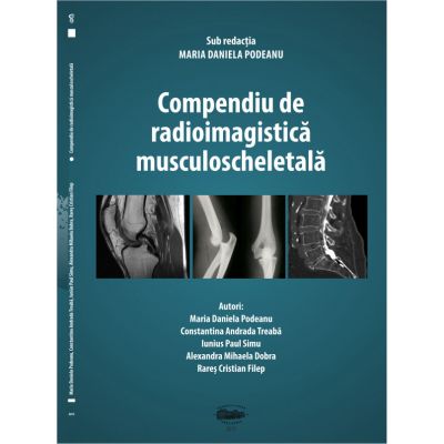 Compendiu de radioimagistica musculoscheletala - Maria Daniela Podeanu