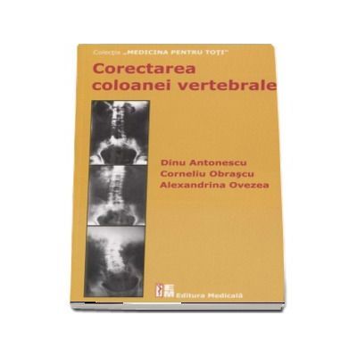 Corectarea coloanei vertebrale (editia a 2-a) - Dinu Antonescu