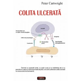 Colita ulcerata - Peter Cartwright