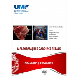 Malformatii cardiace fetale - Claudiu Marginean