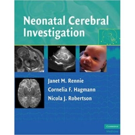 Neonatal Cerebral Investigation - Janet M. Rennie, Cornelia F. Hagmann, Nicola J. Robertson