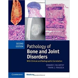 Pathology of Bone and Joint Disorders Print and Online Bundle: With Clinical and Radiographic Correlation - Edward F. McCarthy, Frank J. Frassica