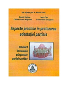 Aspecte practice in protezarea edentatiei partiale. Volumul I - Mihaela Pauna