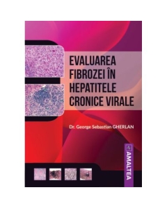 Evaluarea fibrozei in hepatitele cronice virale - George Sebastian Gherlan