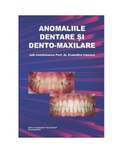 Anomaliile dentare si dento-maxilare - Ecaterina Ionescu