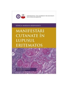Manifestari cutanate in lupusul eritematos - Ionica-Mariana Radulescu