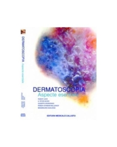 Dermatoscopia Aspecte Esentiale - Robert H. Johr H. Peter Soyer Giuseppe Argentiano Rainer Hofmann Wellenhof Massimiliano Scalvenzi