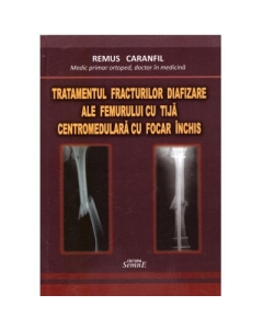 Tratamentul fracturilor diafizare ale femurului cu tija centromedulara cu focar inchis - Remus Caranfil