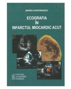 Ecografia in infarctul miocardic acut - Maria Dorobantu