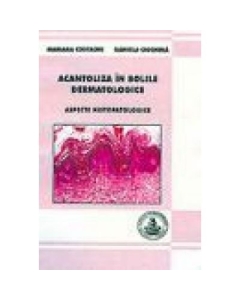 Acantoliza in bolile dermatologice - Mariana Costache, Daniela Ciochina