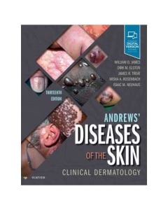 Andrews' Diseases of the Skin. Clinical Dermatology - William D. James, Dirk Elston, James R. Treat, Misha A. Rosenbach, Isaac Neuhaus