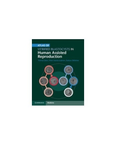 Atlas of Vitrified Blastocysts in Human Assisted Reproduction - Thomas Ebner, Pierre Vanderzwalmen, Barbara Wirleitner