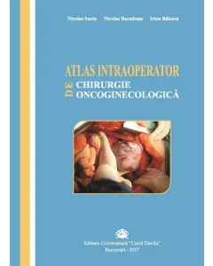 Atlas intraoperator de chirurgie oncoginecologica - Nicolae Suciu, Nicolae Bacalbasa, Irina Balescu