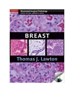 Breast - Thomas J. Lawton MD