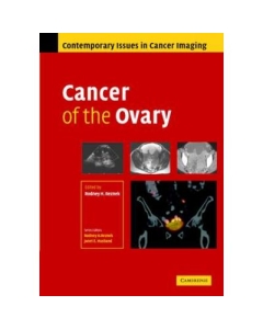 Cancer of the Ovary - Rodney Reznek