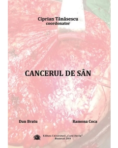 Cancerul de san - Ciprian Tanasescu