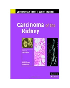 Carcinoma of the Kidney - Uday Patel