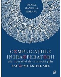 Complicatiile intraoperatorii ale operatiei de cataracta prin facoemulsificare - Dr. Ozana Moraru