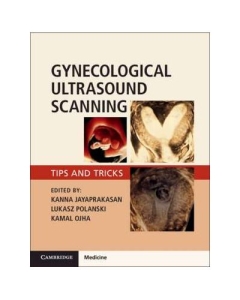 Gynaecological Ultrasound Scanning: Tips and Tricks - Kanna Jayaprakasan, Lukasz Polanski, Kamal Ojha