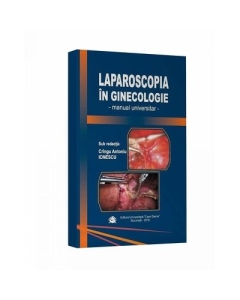 Laparoscopia in ginecologie. Manual universitar