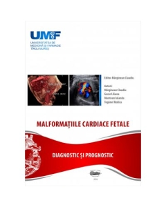 Malformatii cardiace fetale - Claudiu Marginean