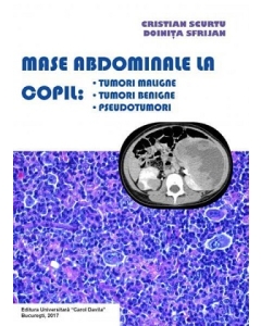 Mase abdominale la copil. Tumori maligne, tumori benigne, pseudotumori - Cristian Scurtu, Doinita Sfrijan