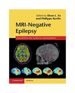 MRI-Negative Epilepsy: Evaluation and Surgical Management - Elson L. So, Philippe Ryvlin