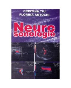 Neurosonologie - Cristina Tiu, Florina Antochi