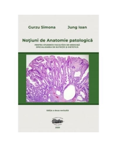 Notiuni de anatomie patologica pentru studentii Facultatii de medicina, specializarea nutritie si dietetica. Editia 2 - Simona Gurzu