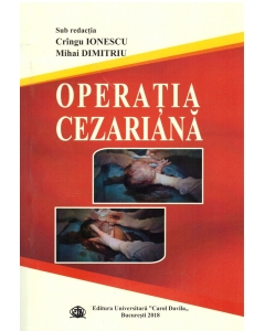 Operatia cezariana - Cringu Ionescu, Mihai Dimitriu