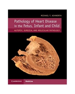 Pathology of Heart Disease in the Fetus, Infant and Child: Autopsy, Surgical and Molecular Pathology - Michael T. Ashworth