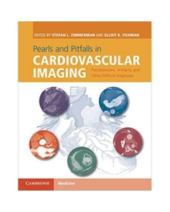 Pearls and Pitfalls in Cardiovascular Imaging: Pseudolesions, Artifacts, and Other Difficult Diagnoses - Stefan L. Zimmerman, Elliot K. Fishman