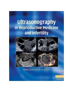 Ultrasonography in Reproductive Medicine and Infertility - Botros R. M. B. Rizk