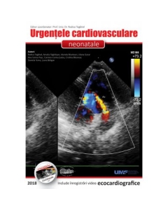 Urgentele cardiovasculare neonatale + DVD - Rodica Toganel