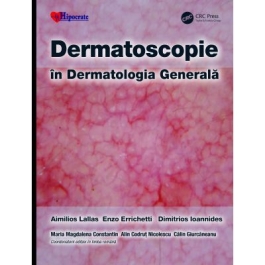 Dermatoscopie in Dermatologia Generala - Aimilios Lallas Enzo Errichetti Dimitrios Ioannides Calin Giurcaneanu Maria Magdalena Constantin Alin Codrut Nicolescu