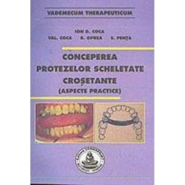 Conceperea protezelor scheletate crosetante