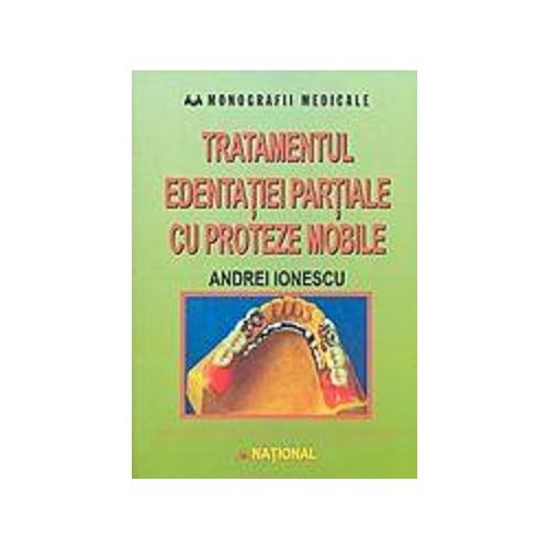 Tratamentul edentatiei partiale cu proteze mobile - Andrei Ionescu
