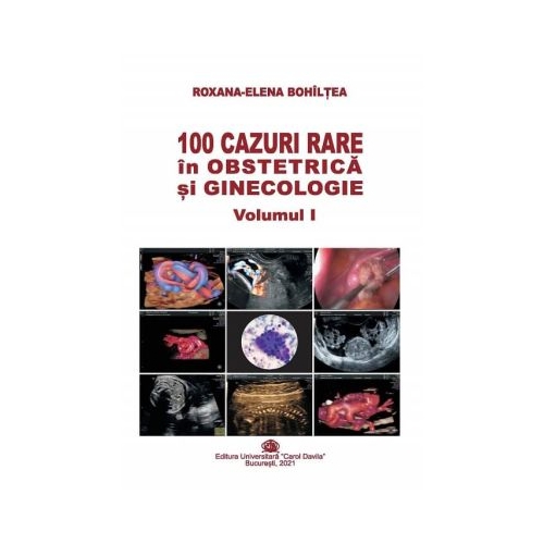 100 cazuri rare in obstetrica si ginecologie volumul 1 - Roxana-Elena Bohiltea