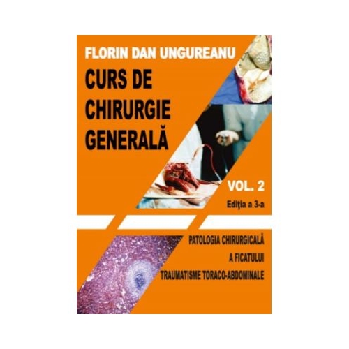 Curs de chirurgie generala. Vol. 2. Editia a 3-a - Florin Dan Ungureanu