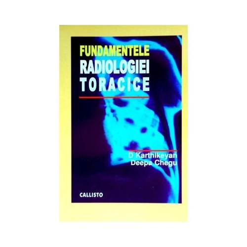 Fundamentele Radiologiei Toracice - D. Karthikeyan D. Chegu