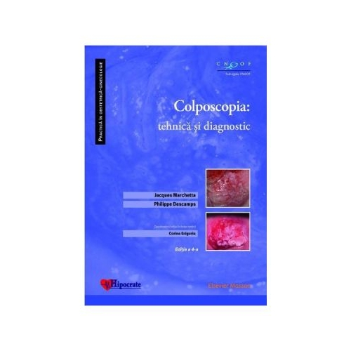 Colposcopia. Tehnica si diagnostic - Jacques Marchetta Philippe Descamps Corina Grigoriu