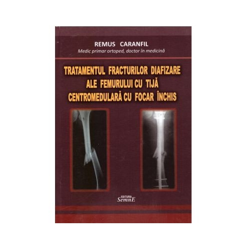 Tratamentul fracturilor diafizare ale femurului cu tija centromedulara cu focar inchis - Remus Caranfil