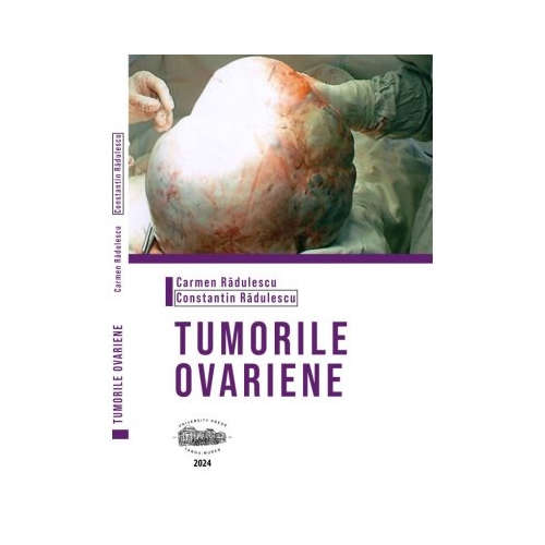 Tumorile ovariene color - Carmen Radulescu
