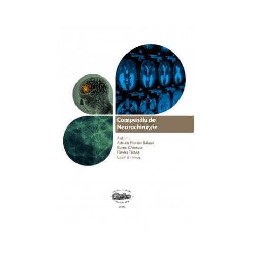 Compendiu de neurochirurgie - Adrian Balasa